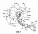 Fig. 02 - Cardiac ablation devices and methods