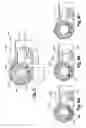 Fig. 04 - Remotely adjustable tissue displacement device