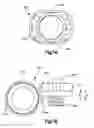 Fig. 05 - Remotely adjustable tissue displacement device
