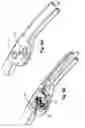 Fig. 10 - Remotely adjustable tissue displacement device