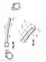 Fig. 13 - Remotely adjustable tissue displacement device
