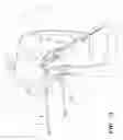 Fig. 11 - Surgical Device for Anterolateral and Posterolateral Reconstruction