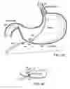 Fig. 06 - ROBOTIC MEDICAL INSTRUMENT SYSTEM