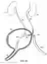 Fig. 09 - ROBOTIC MEDICAL INSTRUMENT SYSTEM