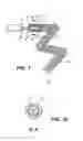 Fig. 02 - Method and apparatus for the deployment of vaso-occlusive coils