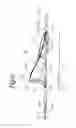 Fig. 05 - EMBOLUS EXTRACTOR