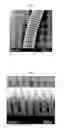 Fig. 02 - Plasma-treated vascular occlusion devices and methods