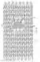 Fig. 09 - Stent with overlap and high extension