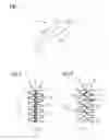 Fig. 02 - Support Prosthesis