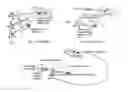 Fig. 01 - FEMUR HEAD CENTER LOCALIZATION