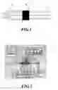 Fig. 02 - Amperometric sensor for uric acid and method for the same