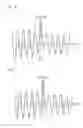 Fig. 09 - Apparatus for optical pick-up