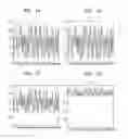 Fig. 02 - Information recording medium in which pre-pit is formed and recording/reproducing apparatus and method