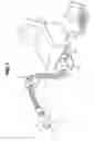 Fig. 02 - Electronic endoscope