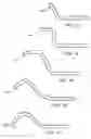 Fig. 14 - Annuloplasty device having a helical anchor and methods for its use