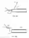 Fig. 18 - Annuloplasty device having a helical anchor and methods for its use