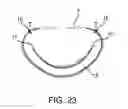 Fig. 19 - Annuloplasty device having a helical anchor and methods for its use