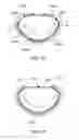 Fig. 21 - Annuloplasty device having a helical anchor and methods for its use