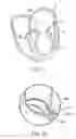 Fig. 24 - Annuloplasty device having a helical anchor and methods for its use