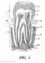 Fig. 02 - Methods for treating dental conditions using tissue scaffolds