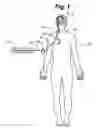 Fig. 02 - METHOD AND APPARATUS FOR DETECTION OF NERVOUS SYSTEM DISORDERS