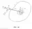 Fig. 05 - Ablation probe with ribbed insulated sheath