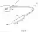 Fig. 02 - Catheter and Method for Dilating a Body Passageway