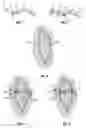 Fig. 02 - Tissue Approximator and Retractor Assistive Device