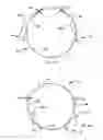 Fig. 08 - Expandable covered stent with wide range of wrinkle-free deployed diameters
