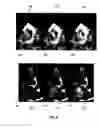 Fig. 07 - Method and apparatus for 3D visualization of flow jets