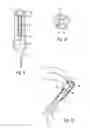 Fig. 07 - Disposable device and method for transferring an active liquid into a body cavity