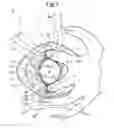 Fig. 02 - Excrement disposal device