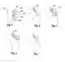 Fig. 04 - Stability enhancing system for tow-vehicle towing trailer assembly