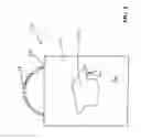 Fig. 03 - Ballon anchoring structure with light emitting functionality