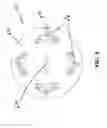 Fig. 09 - Ballon anchoring structure with light emitting functionality