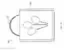 Fig. 16 - Ballon anchoring structure with light emitting functionality