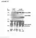 Fig. 05 - Prion-like form of CPEB and related compositions and methods