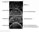 Fig. 16 - Prion-like form of CPEB and related compositions and methods