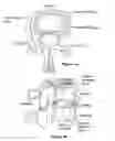 Fig. 02 - Selective delivery of cryogenic energy to intervertebral disc tissue and related methods of intradiscal hypothermia therapy