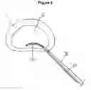 Fig. 06 - Selective delivery of cryogenic energy to intervertebral disc tissue and related methods of intradiscal hypothermia therapy