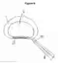 Fig. 07 - Selective delivery of cryogenic energy to intervertebral disc tissue and related methods of intradiscal hypothermia therapy