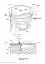 Fig. 05 - Thermal oxidation protective surface for steel pistons