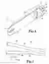 Fig. 04 - Pedal actuated bicycle brake system