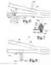 Fig. 05 - Pedal actuated bicycle brake system