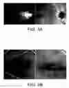 Fig. 07 - Processes, arrangements and systems for providing a fiber layer thickness map based on optical coherence tomography images