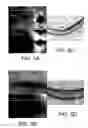 Fig. 09 - Processes, arrangements and systems for providing a fiber layer thickness map based on optical coherence tomography images