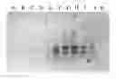 Fig. 01 - Compositions and Methods Relating to CNS Lymphoma