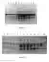 Fig. 04 - Compositions and Methods Relating to CNS Lymphoma