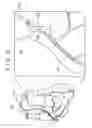 Fig. 04 - Guide wire