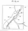 Fig. 05 - Guide wire